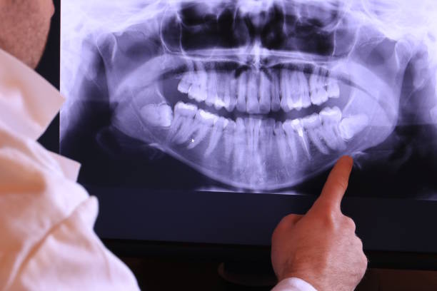 Best Broken or Chipped Tooth Repair in Frisco, TX